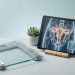 Can Fibroids Cause Weight Gain? Understanding the Connection Between Uterine Tumors and Your Scale